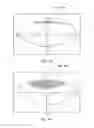 Fig. 26 - System and apparatus for treating the lens of an eye