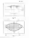Fig. 29 - System and apparatus for treating the lens of an eye
