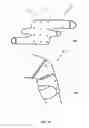 Fig. 18 - Smart joint care