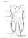 Fig. 03 - Dual component oral composition for enhancing remineralization of teeth