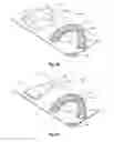 Fig. 04 - Methods for cleaning and remineralizing teeth