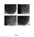 Fig. 03 - COMPOSITIONS INCLUDING APOLIPOPROTEIN AND METHODS USING FOCUSED ACOUSTICS FOR PREPARATION THEREOF