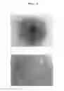 Fig. 05 - Agent for promoting corneal endothelial cell adhesion
