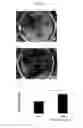 Fig. 06 - Agent for promoting corneal endothelial cell adhesion