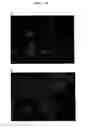 Fig. 09 - Agent for promoting corneal endothelial cell adhesion