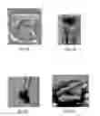 Fig. 09 - Methods of acute restoration of vascular compliance
