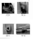 Fig. 10 - Methods of acute restoration of vascular compliance