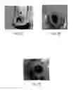 Fig. 11 - Methods of acute restoration of vascular compliance