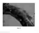 Fig. 12 - Methods of acute restoration of vascular compliance