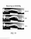 Fig. 18 - Methods of acute restoration of vascular compliance
