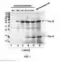 Fig. 02 - USE OF A CLAY PRODUCT OR A CLAY BLEND PRODUCT TO DECREASE THE EFFECTS OF BACTERIAL DISEASE IN SHRIMP