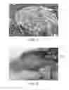 Fig. 04 - METHOD FOR REVERSING RECENT-ONSET TYPE 1 DIABETES (T1D) BY ADMINISTERING SUBSTANCE P (sP)