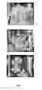 Fig. 04 - Use of antisecretory factors (AF) for optimizing cellular uptake