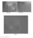 Fig. 03 - Method of Induction and Purification of a Cell Population Responsible for Vascular Mimicry and Use of Same