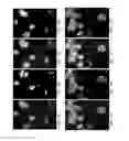 Fig. 05 - Method of Induction and Purification of a Cell Population Responsible for Vascular Mimicry and Use of Same