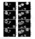 Fig. 06 - Method of Induction and Purification of a Cell Population Responsible for Vascular Mimicry and Use of Same
