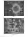 Fig. 03 - Individualized High Purity Glioblastoma Multiforme Stem Cells and Methods for Stimulating Immune Response