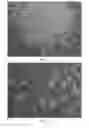 Fig. 04 - Individualized High Purity Glioblastoma Multiforme Stem Cells and Methods for Stimulating Immune Response