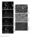 Fig. 05 - Individualized High Purity Glioblastoma Multiforme Stem Cells and Methods for Stimulating Immune Response