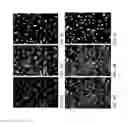 Fig. 06 - Individualized High Purity Glioblastoma Multiforme Stem Cells and Methods for Stimulating Immune Response