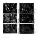 Fig. 07 - Individualized High Purity Glioblastoma Multiforme Stem Cells and Methods for Stimulating Immune Response