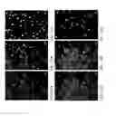 Fig. 08 - Individualized High Purity Glioblastoma Multiforme Stem Cells and Methods for Stimulating Immune Response