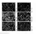 Fig. 09 - Individualized High Purity Glioblastoma Multiforme Stem Cells and Methods for Stimulating Immune Response