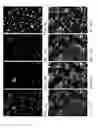 Fig. 10 - Individualized High Purity Glioblastoma Multiforme Stem Cells and Methods for Stimulating Immune Response