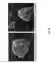 Fig. 93 - Eutectic formulations of cyclobenzaprine hydrochloride and amitriptyline hydrochloride
