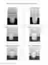 Fig. 02 - Topical dapsone and dapsone/adapalene compositions and methods for use thereof