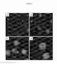 Fig. 07 - Imageable embolic microsphere