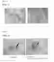 Fig. 04 - Kit for adhering biological hard tissues