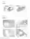 Fig. 05 - Kit for adhering biological hard tissues