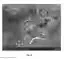 Fig. 08 - Injectable Biodegradable Bone Matrix for Multiple Myeloma Lesion Augmentation and Osteoporosis