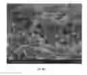 Fig. 09 - Injectable Biodegradable Bone Matrix for Multiple Myeloma Lesion Augmentation and Osteoporosis