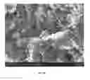 Fig. 11 - Injectable Biodegradable Bone Matrix for Multiple Myeloma Lesion Augmentation and Osteoporosis