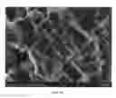 Fig. 13 - Injectable Biodegradable Bone Matrix for Multiple Myeloma Lesion Augmentation and Osteoporosis