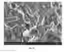 Fig. 14 - Injectable Biodegradable Bone Matrix for Multiple Myeloma Lesion Augmentation and Osteoporosis