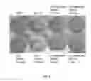 Fig. 15 - Injectable Biodegradable Bone Matrix for Multiple Myeloma Lesion Augmentation and Osteoporosis