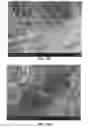 Fig. 19 - Injectable Biodegradable Bone Matrix for Multiple Myeloma Lesion Augmentation and Osteoporosis