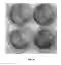Fig. 22 - Injectable Biodegradable Bone Matrix for Multiple Myeloma Lesion Augmentation and Osteoporosis