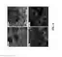 Fig. 09 - Bonding of Titanium Coating to Cast CoCr