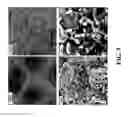 Fig. 10 - Bonding of Titanium Coating to Cast CoCr