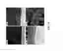 Fig. 15 - Bonding of Titanium Coating to Cast CoCr