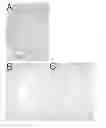 Fig. 01 - Method for decellularization of tissue grafts