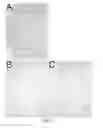 Fig. 02 - Method for decellularization of tissue grafts