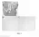 Fig. 05 - Method for decellularization of tissue grafts