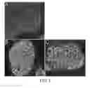 Fig. 06 - Method for decellularization of tissue grafts