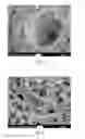 Fig. 03 - USE OF MICROPARTICLES AND ENDOTHELIAL CELLS WITH DECELLULARIZED ORGANS AND TISSUES