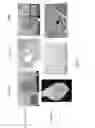 Fig. 07 - USE OF MICROPARTICLES AND ENDOTHELIAL CELLS WITH DECELLULARIZED ORGANS AND TISSUES